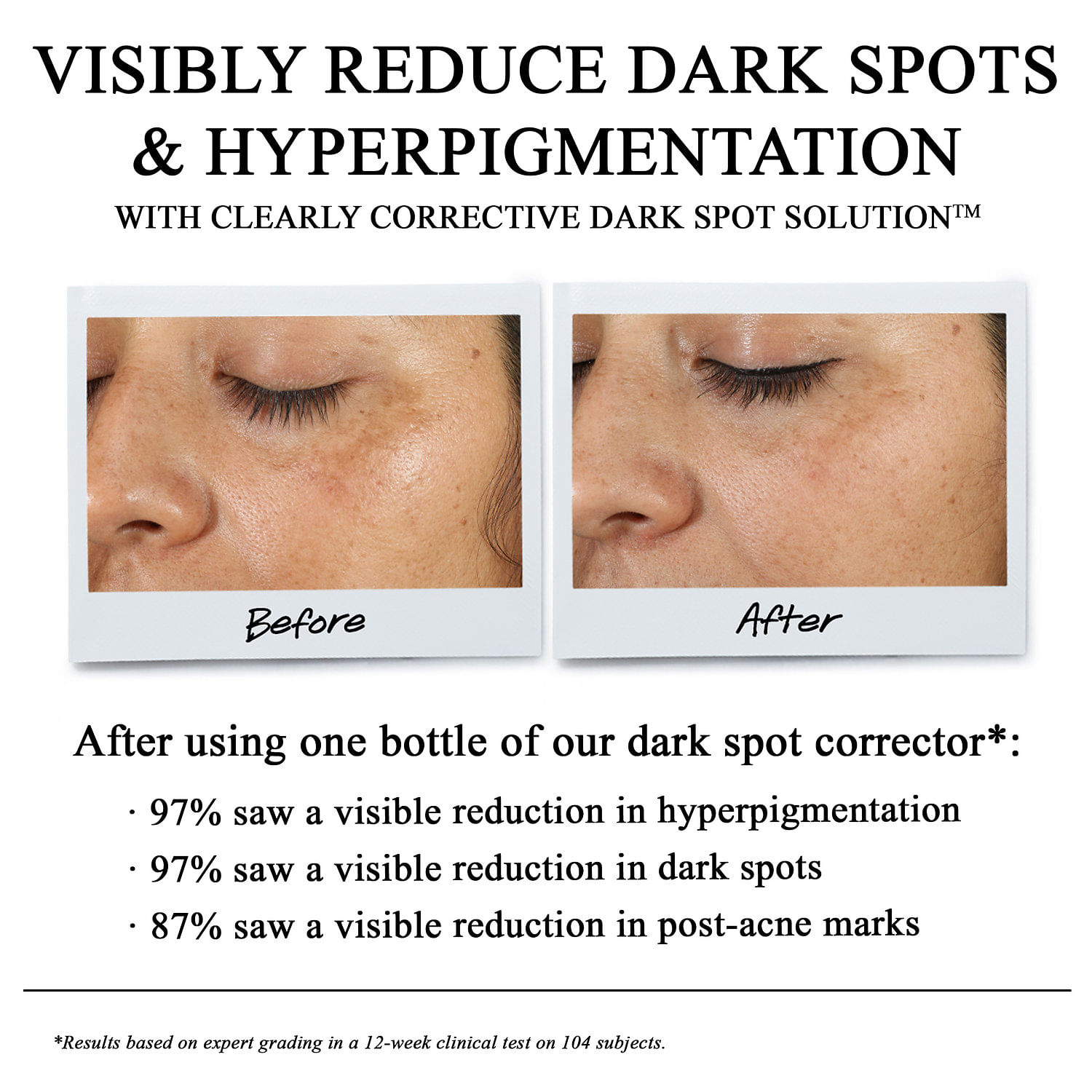 Clearly Corrective Dark Spot Correcting Serum | Oprah Daily Shop