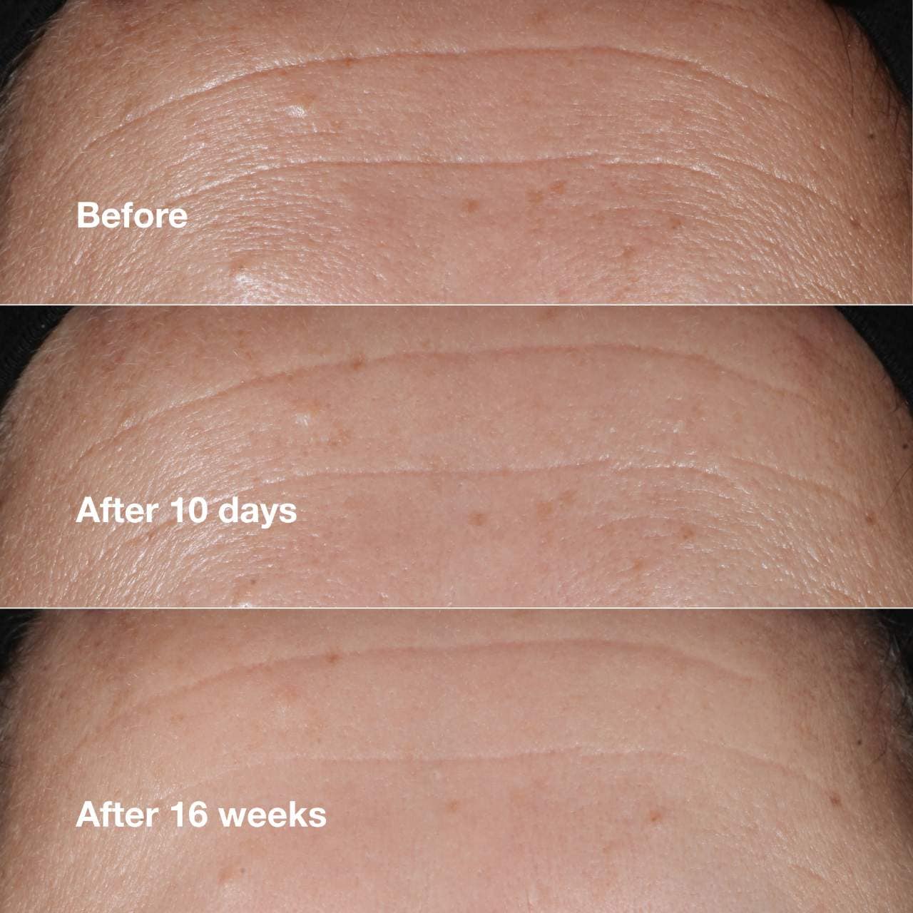 美容液 LAPIDEM Tightening Target Serum 25ml 3x JKxLab RP Retinoids Peptides 1.5% Serum reduce wrinkles