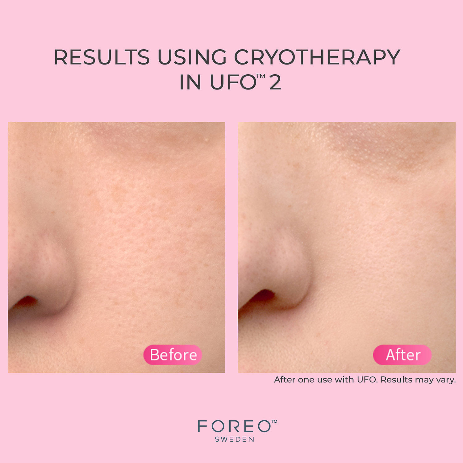 Ufo™ 2 | Oprah Daily Shop Ufo™ 2 | Oprah Daily Shop