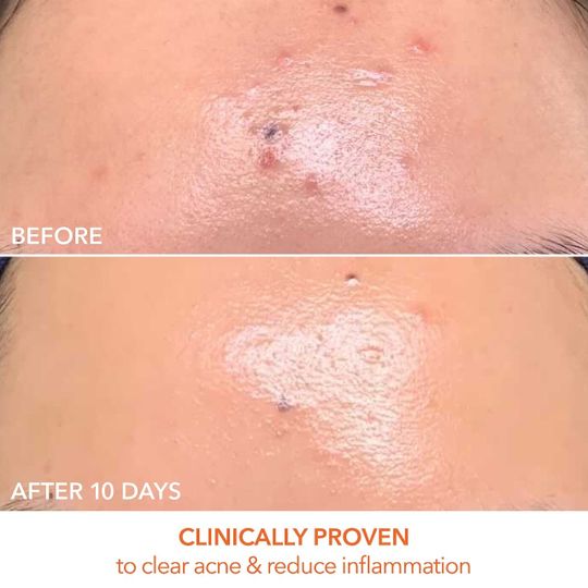 Dr. Dennis Gross Skincare | Oprah Daily Shop